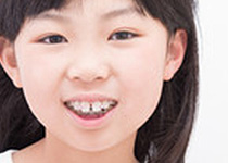 小児矯正歯科
