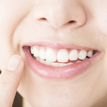 ホワイトニング